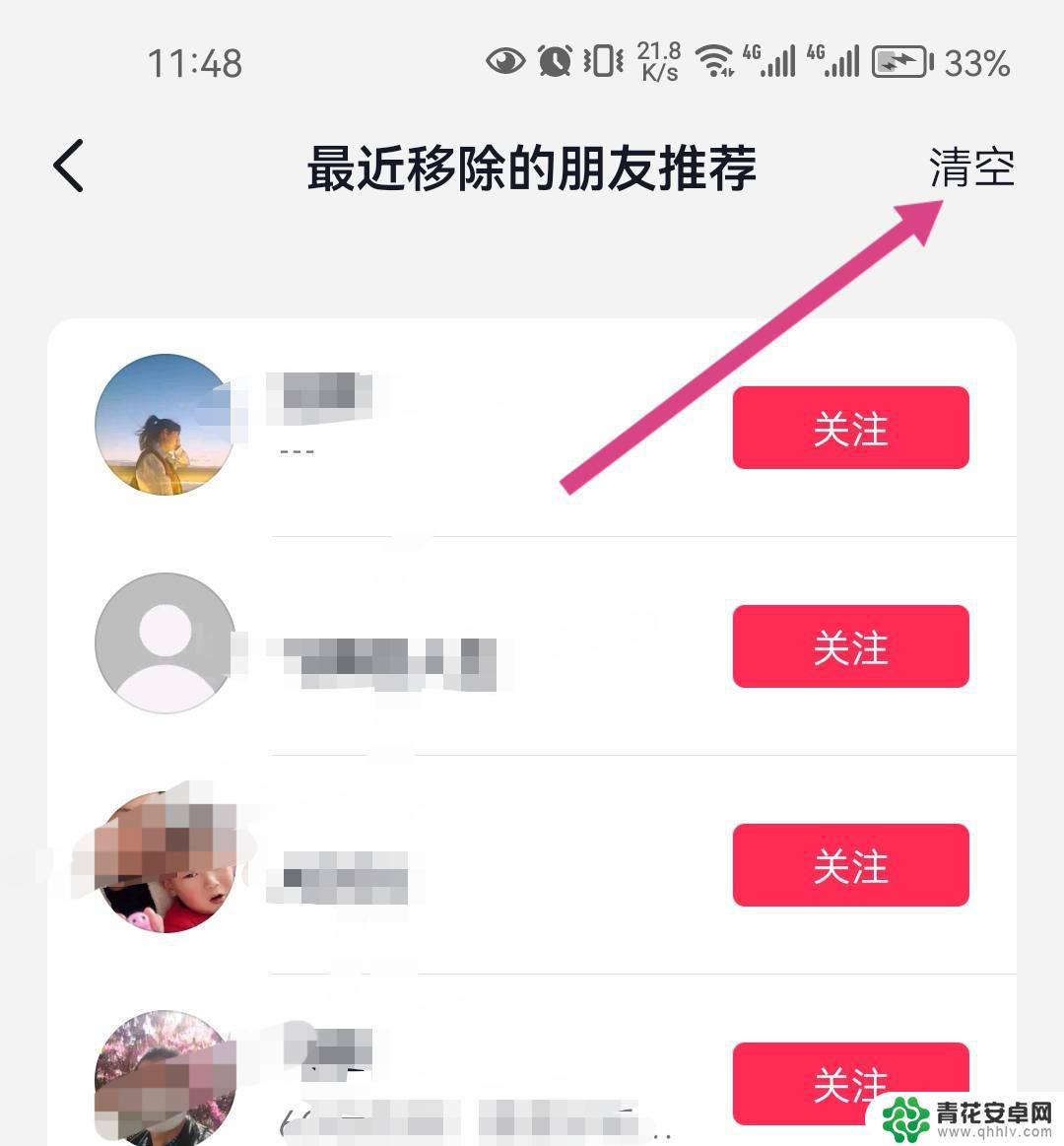 抖音最近移除的朋友推荐怎么删除掉(抖音最近移除的朋友推荐怎么删除掉啊)